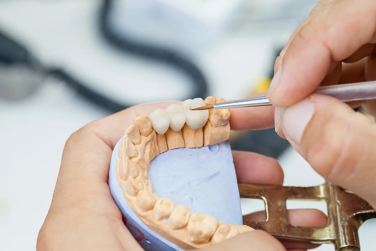 Master dental technician hand-finishing a bespoke porcelain bridge with artistic precision.