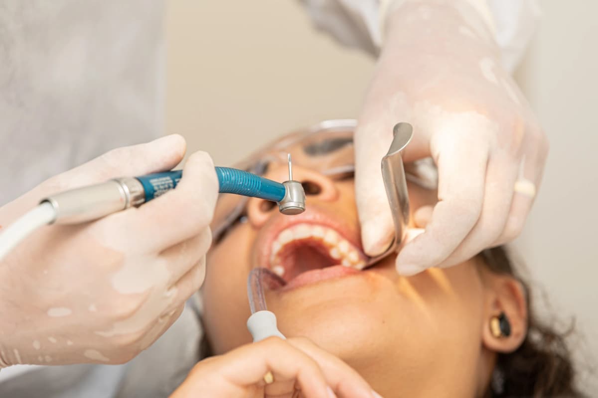 Surgical & Routine Extractions
