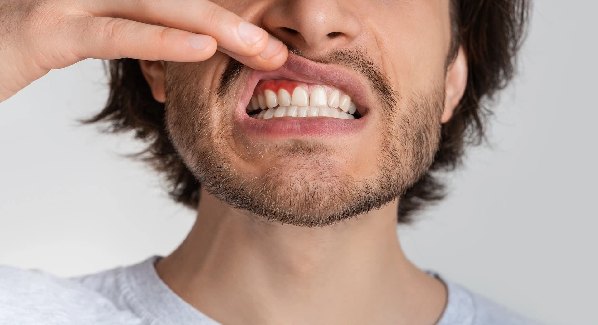 Periodontal Therapy treatment at Maypole Dental Surgery