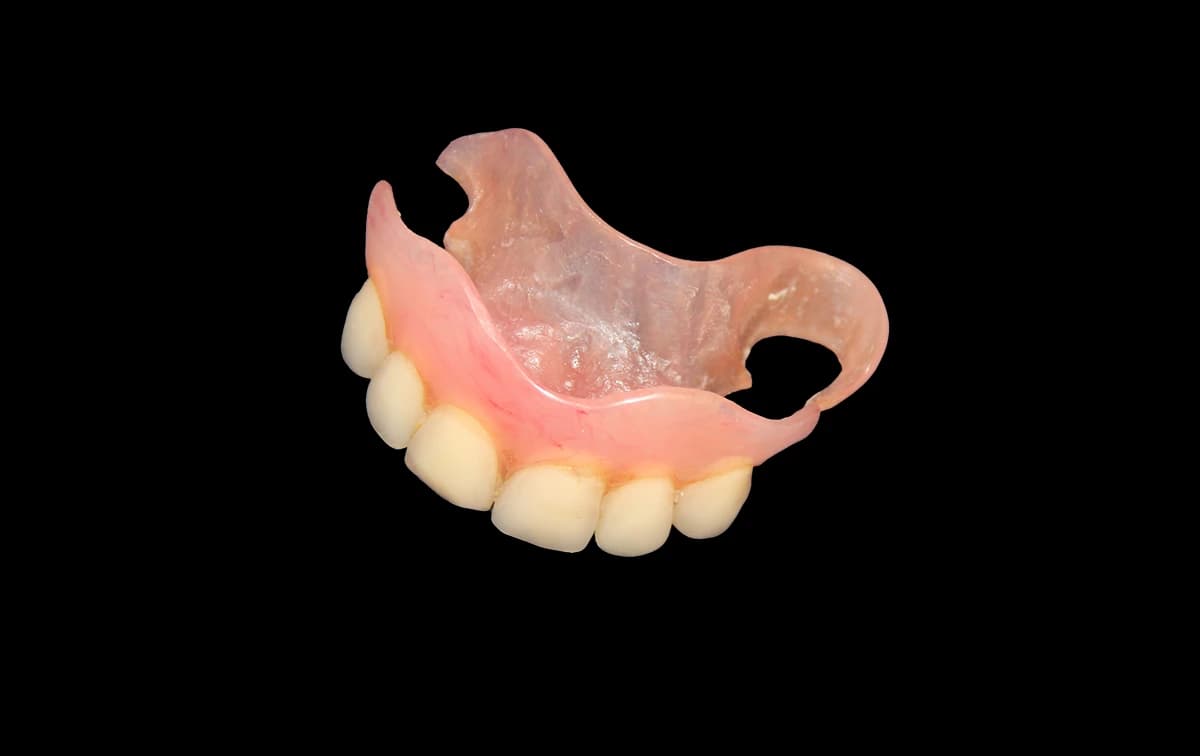 Clinical photo of a hand-crafted flexible denture showing natural gum shading and tooth symmetry.